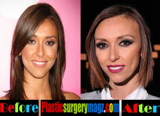 Giuliana Rancic Plastic Surgery Before and After ...