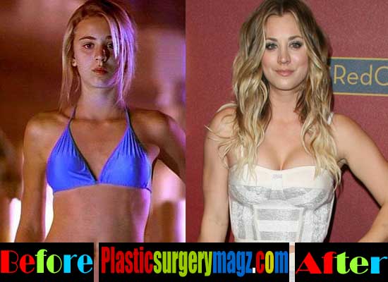 Kaley Cuoco Plastic Surgery Before And After Photos Plastic Surgery Magazine