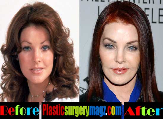 Priscilla Presley Plastic Surgery Disaster Plastic