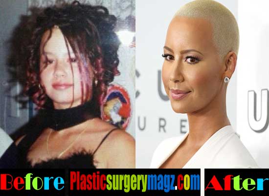 Amber Rose Plastic Surgery Before And After Pictures Plastic Surgery Magazine 