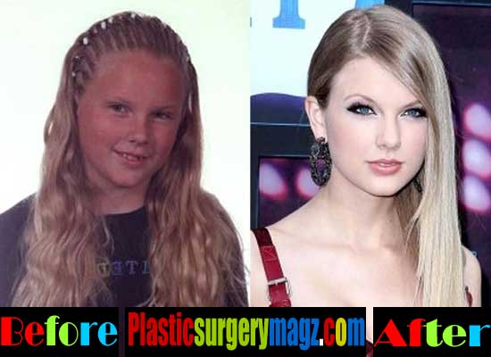 Taylor Swift Plastic Surgery Before And After Pictures Plastic