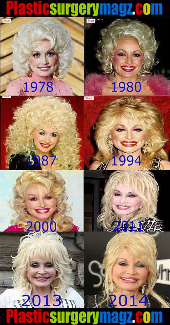 Pictures Of Dolly Parton Without Makeup Plastic Surgery Magazine