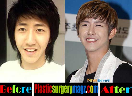 Kwang Hee Plastic Surgery Before And After Plastic Surgery Magazine