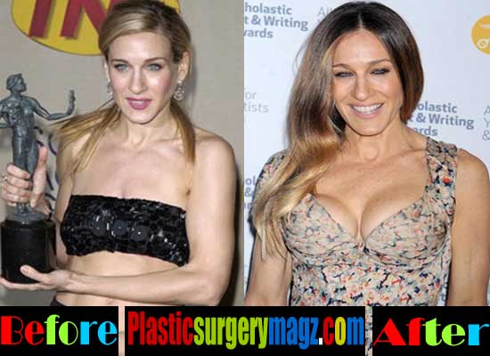Sarah Jessica Parker Boob Job Before And After Pictures Plastic Surgery Magazine