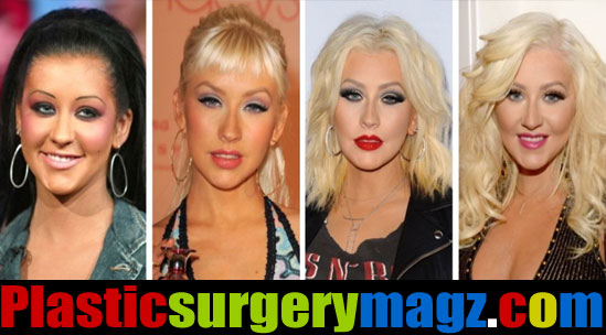 christina aguilera before surgery plastic