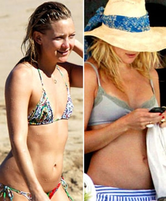 Kate Hudson Boob Job Before And After Pictures Plastic Surgery Magazine 6102