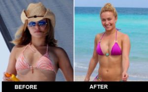 Hayden Panettiere Boob Job Before And After Plastic Surgery Magazine