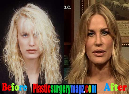 Daryl Hannah Plastic Surgery Gone Wrong Plastic Surgery Magazine 