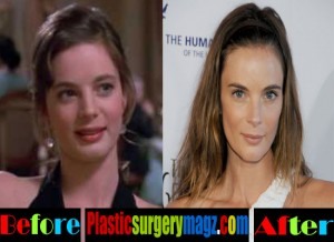 Gabrielle Anwar Plastic Surgery Before and After - Plastic Surgery Magazine
