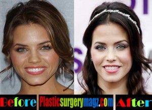 Jenna Dewan Plastic Surgery: Before and After Transformation - Plastic