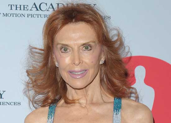 Tina Louise Plastic Surgery