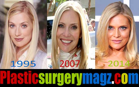 Emily Procter Plastic Surgery Procedures.