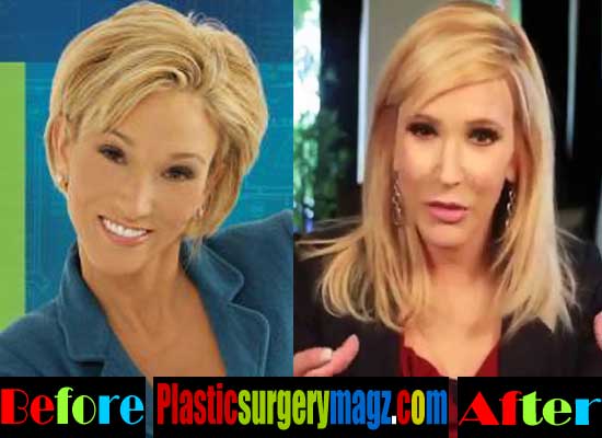Paula White Plastic Surgery Before and After Plastic Surgery Magazine