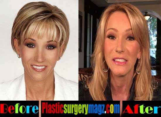 Paula White Plastic Surgery Before and After | Plastic ...