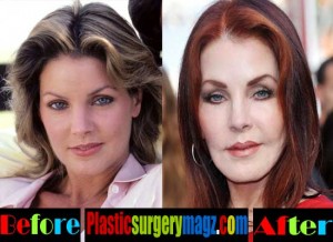 Priscilla Presley Plastic Surgery Disaster Plastic Surgery Magazine