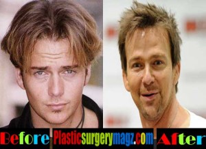 Sean Patrick Flanery Plastic Surgery Before and After | Plastic Surgery ...