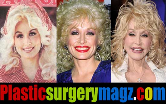 Dolly Parton Plastic Surgery Before and After Pictures ...