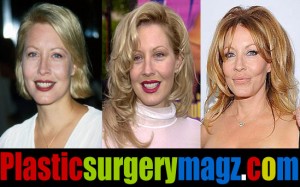 Linda Kozlowski Plastic Surgery Before and After | Plastic ...