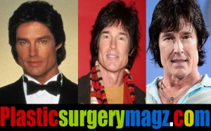 Ronn Moss Plastic Surgery Before and After - Plastic Surgery Magazine