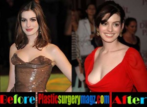 anne hathaway breast reduction Image 7