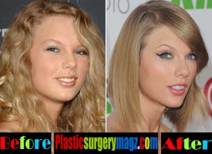 Taylor Swift Nose Job Before and After | Plastic Surgery Magazine