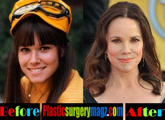 Barbara Hershey Plastic Surgery Before and After.
