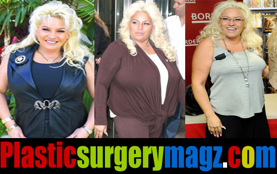 Beth Chapman Plastic Surgery Before and After Pictures ...