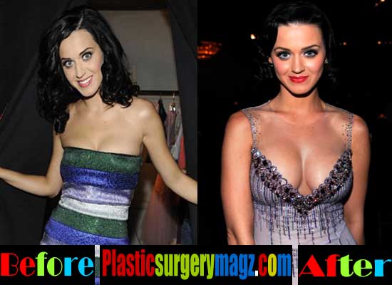 katy perry before and after implants