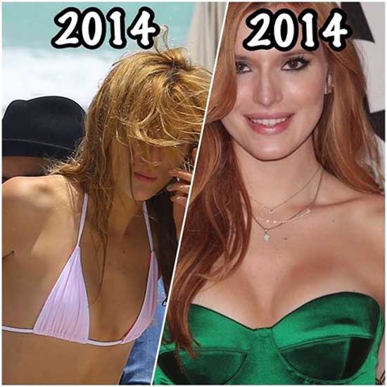 Bella Thorne Boob Job Then and Now.