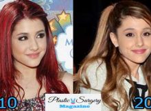 ariana grande nose job 2015