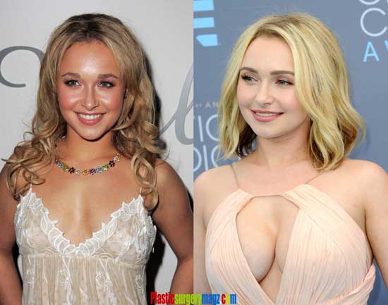 Hayden Panettiere Boob Job Before and After Pictures.