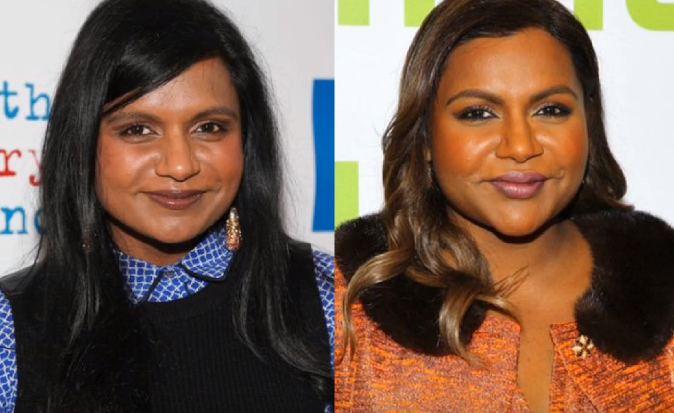 Mindy Kaling lip injection