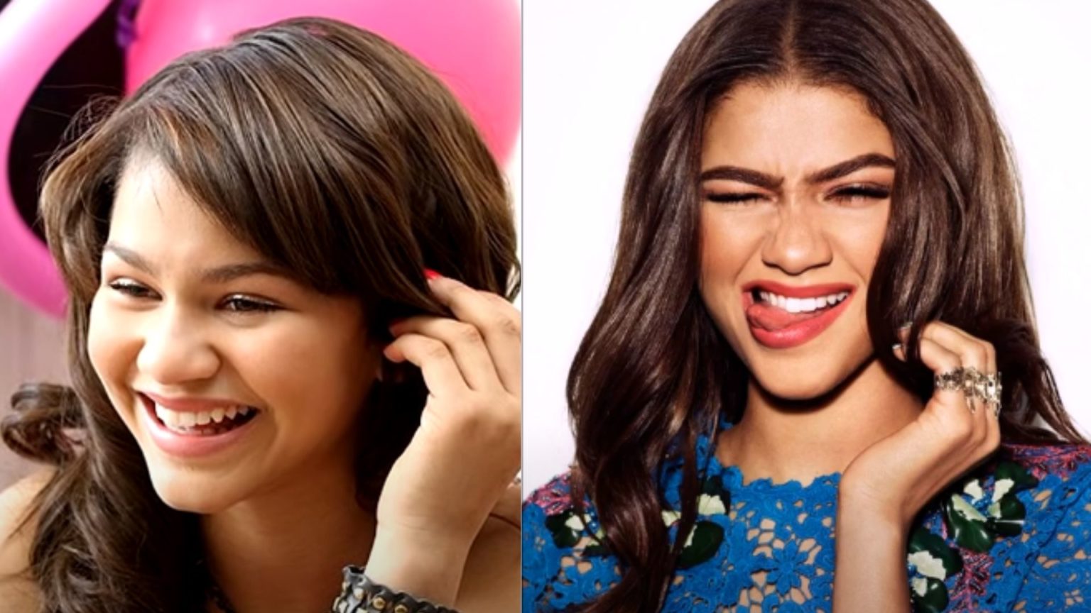 Zendaya Plastic Surgery Before and After Plastic