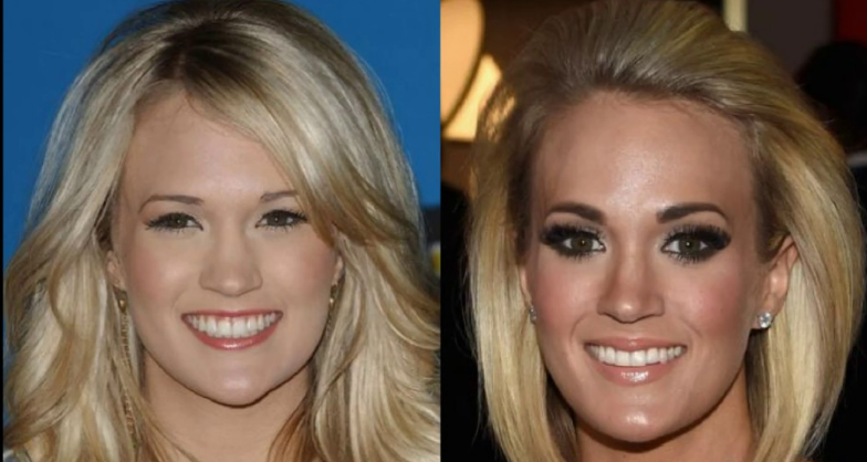 Carrie Underwood's Journey: A Look at Her Cosmetic Enhancements