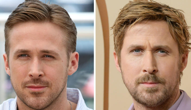 The Truth Behind Ryan Gosling's Plastic Surgery Speculations