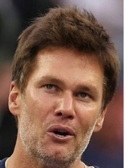 Fan Reactions: Tom Brady and the Plastic Surgery Debate