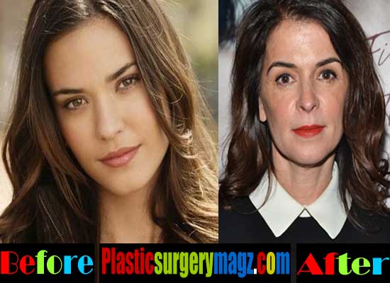 Understanding the Speculations Around Annabella Sciorra Plastic Surgery