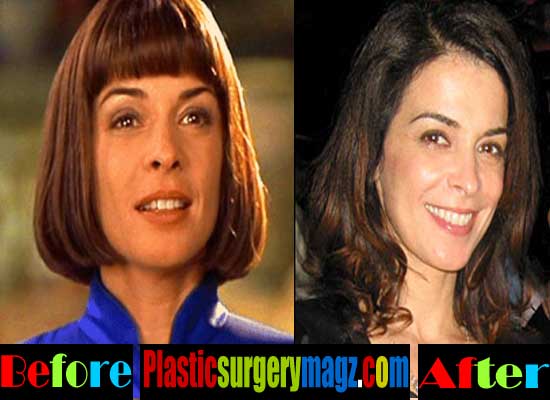 The Impact of Aging on Annabella Sciorra's Appearance Over Time