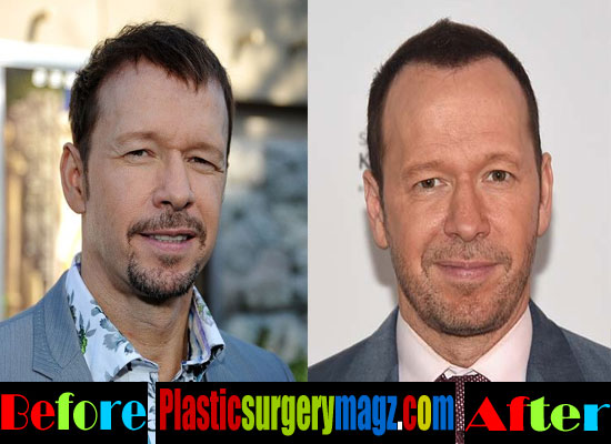 The Evolution of Donnie Wahlberg: A Closer Look at His Changes